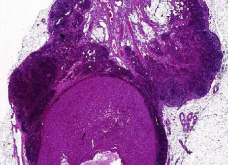 Image for Spatial Transcriptomic Imputation