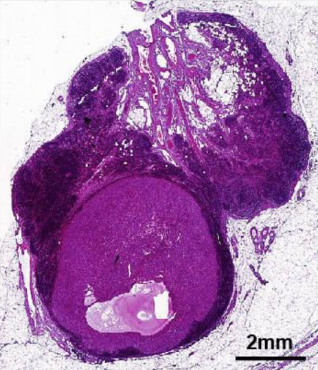 Image for Spatial Transcriptomic Imputation